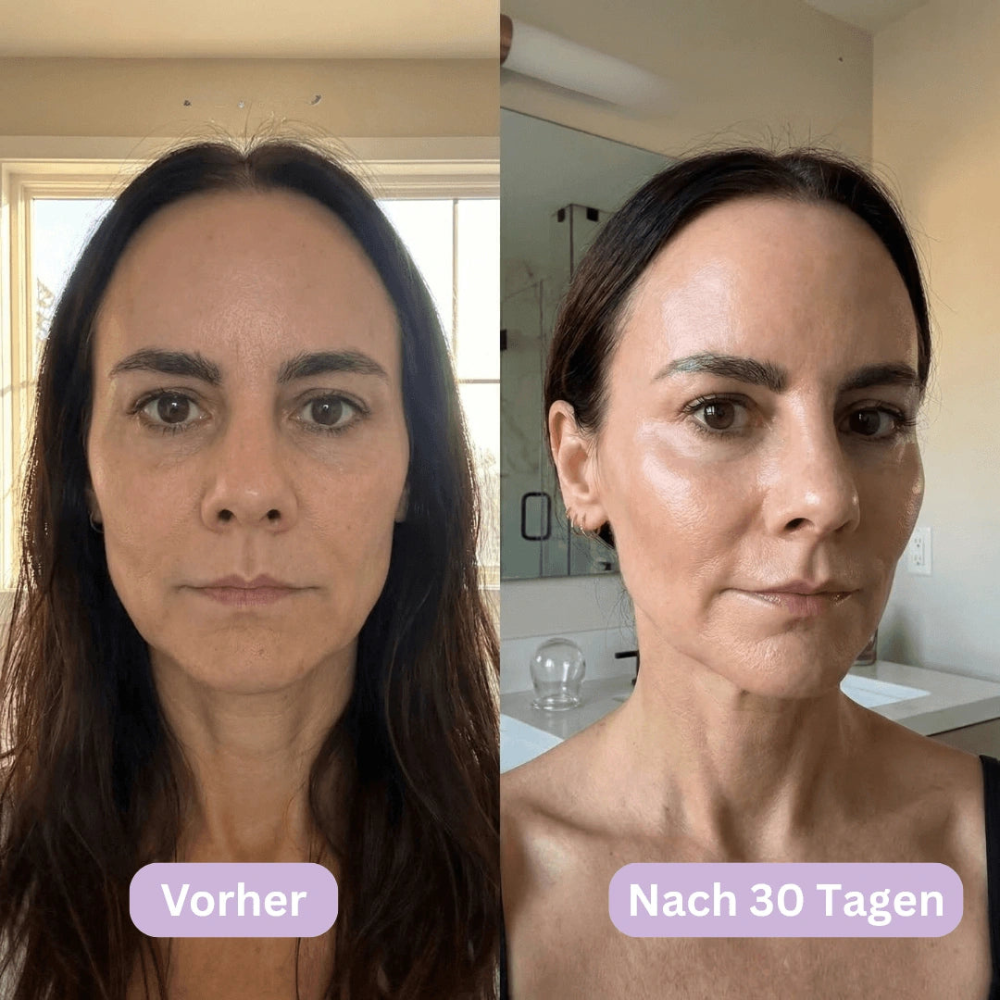 LymphCup™ - Endlich wieder aussehen wie du dich fühlst