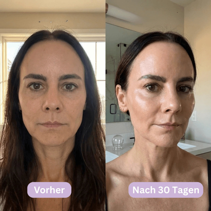 LymphCup™ - Endlich wieder aussehen wie du dich fühlst