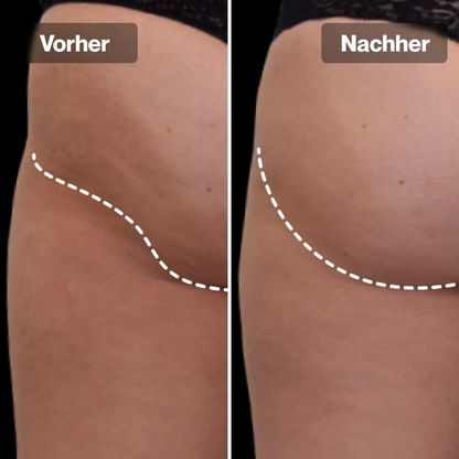 PulseFit Shorts™ - Strafferer Po in 3 Wochen