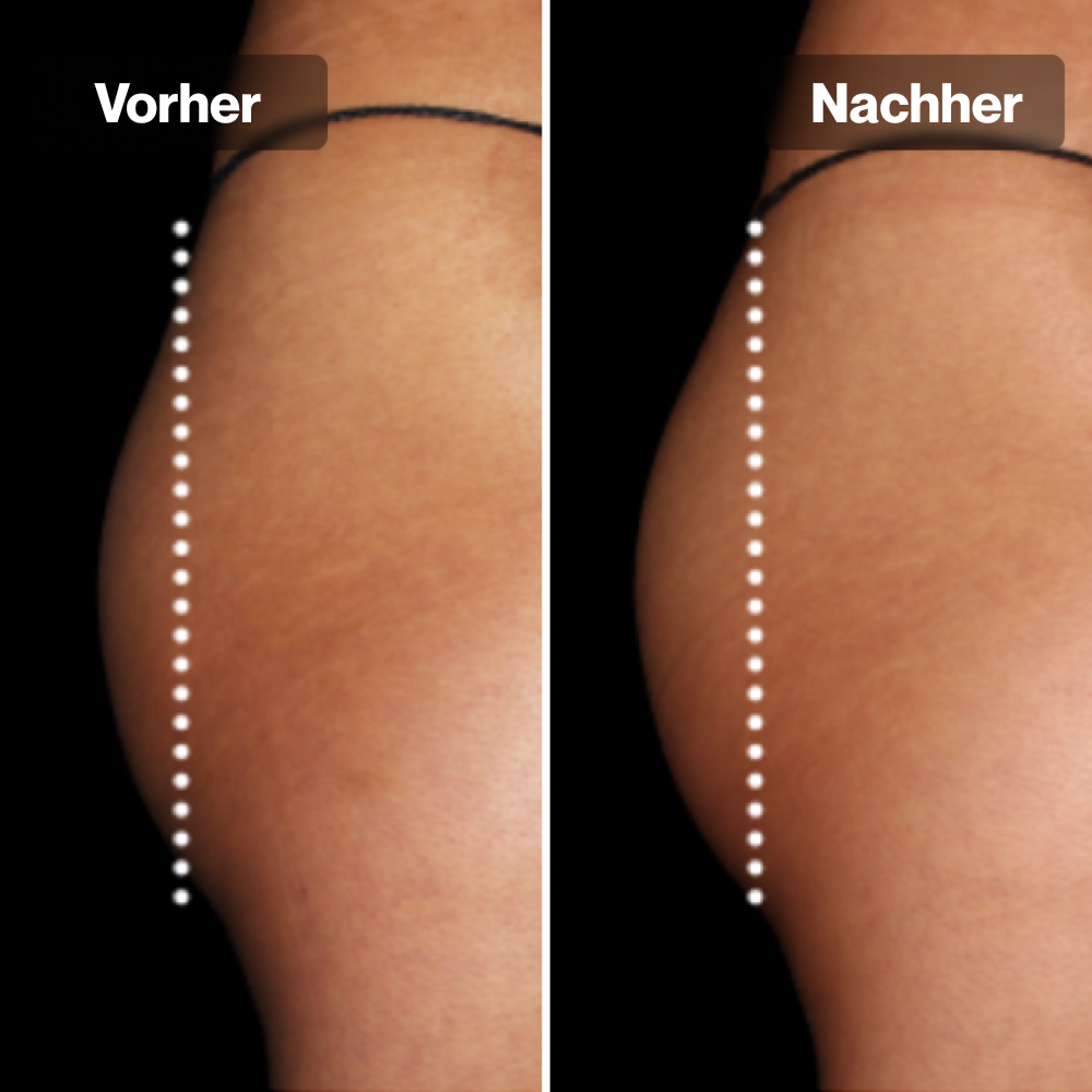 PulseFit Shorts™ - Strafferer Po in 3 Wochen