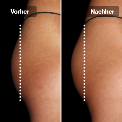 PulseFit Shorts™ - Strafferer Po in 3 Wochen